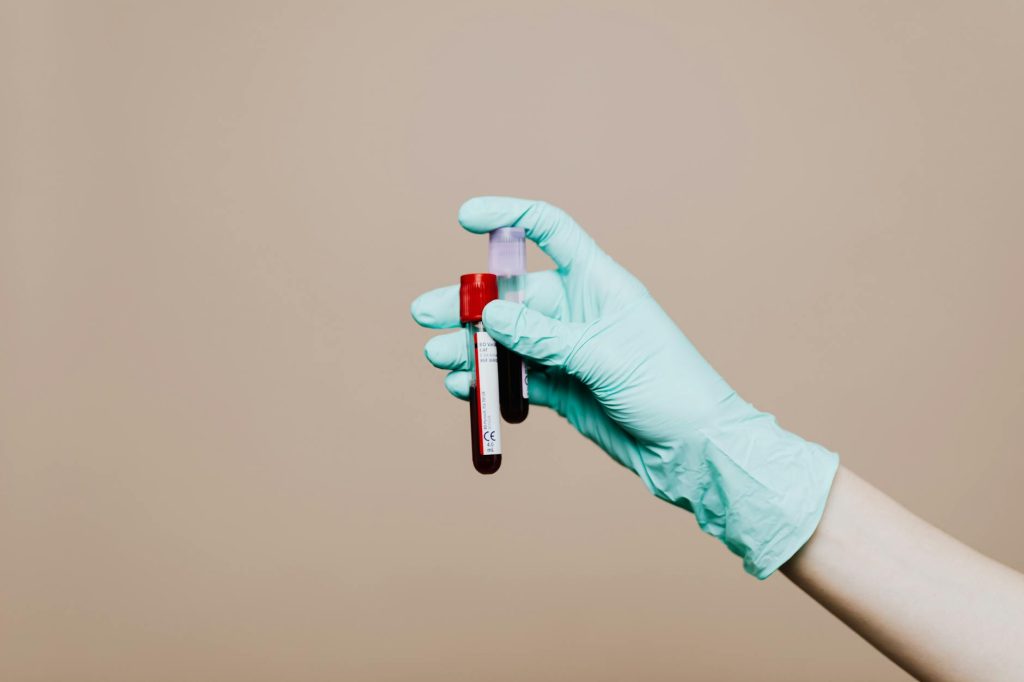 photo of person holding test tubes