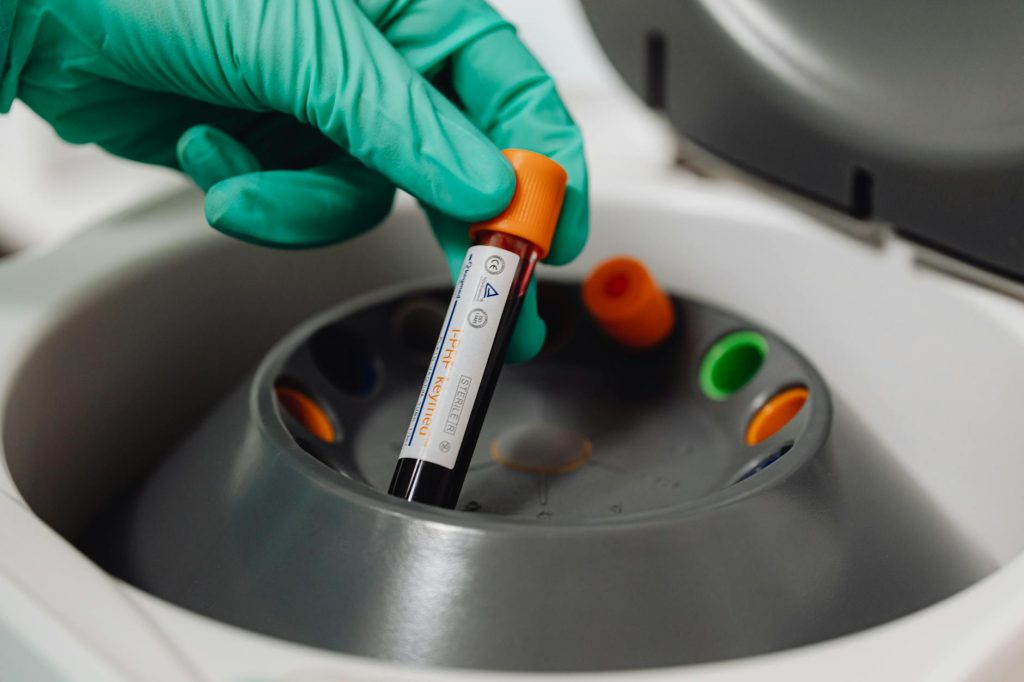 close up of a doctor holding a tube with blood